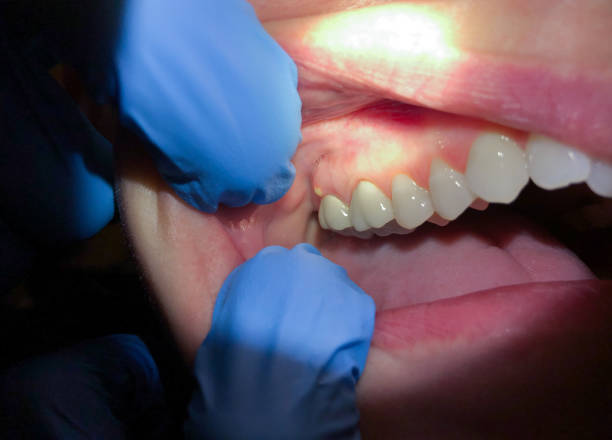 Best Walk-In Emergency Dentist in Walnut Grove, GA