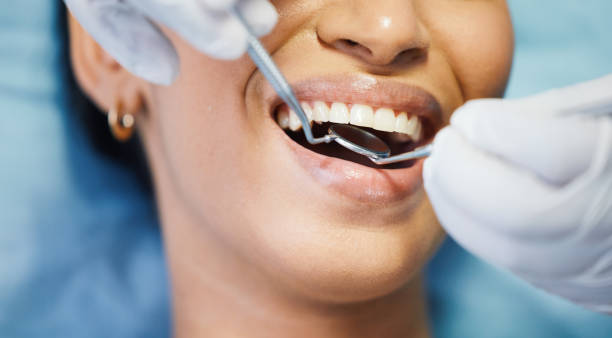Best Emergency Tooth Extraction in Walnut Grove, GA