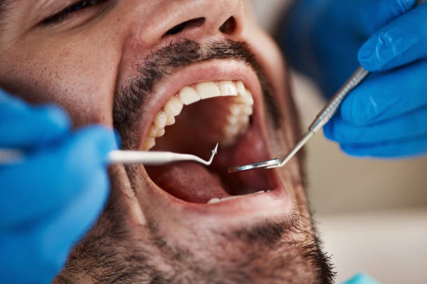 Best Walk-In Emergency Dentist in Walnut Grove, GA